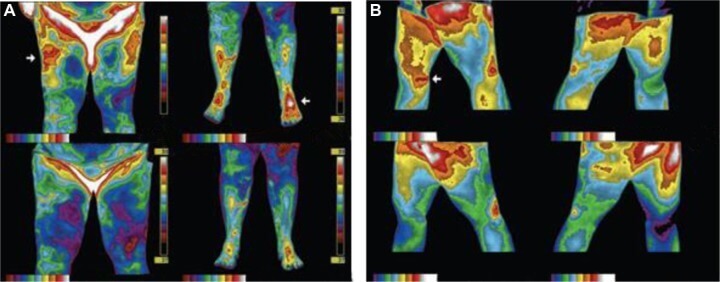 thermal imaging for grounding